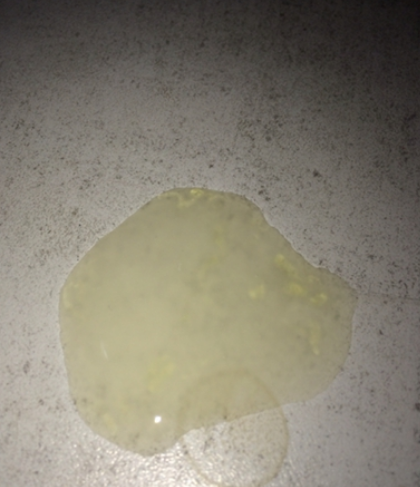 精液土黄色是什么原因