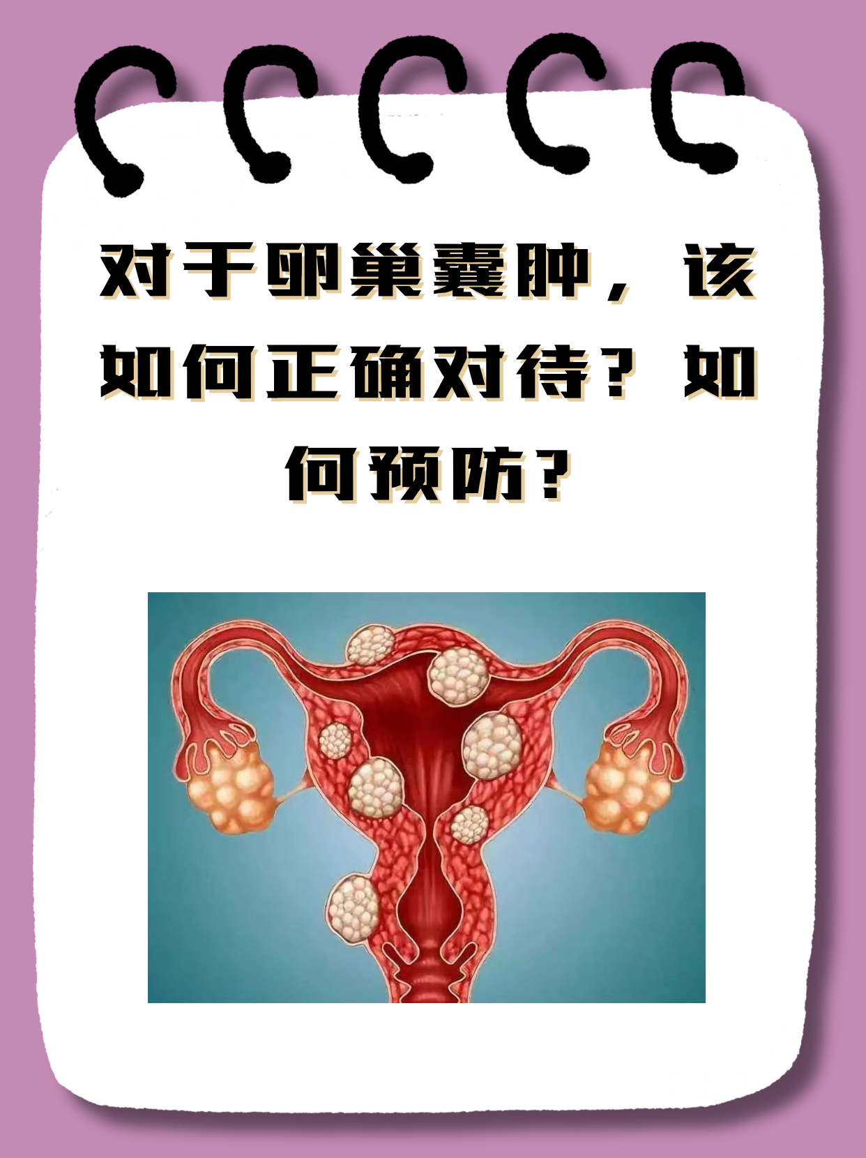 宫颈囊肿需要治疗吗