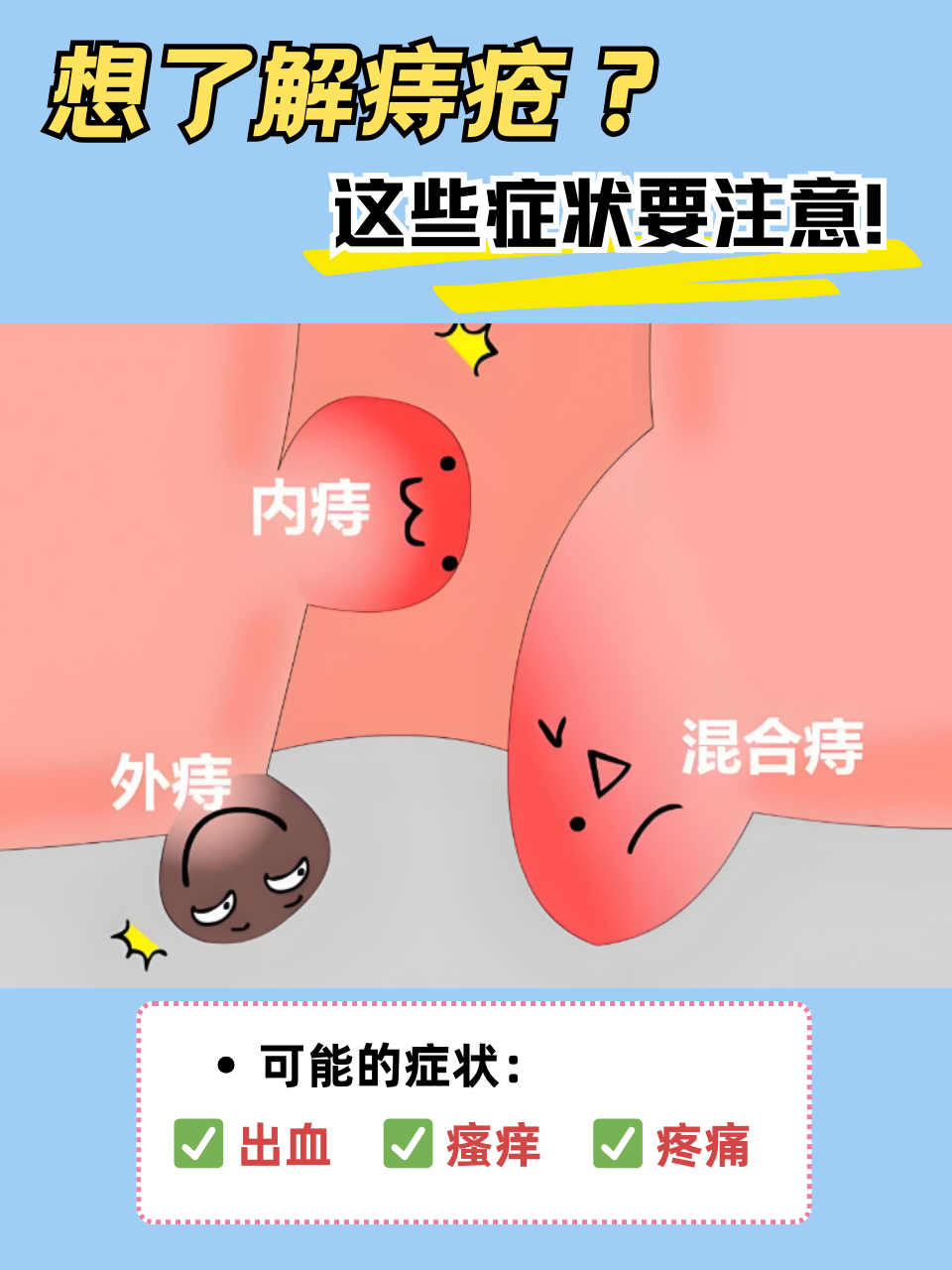 痔疮的症状有哪些?