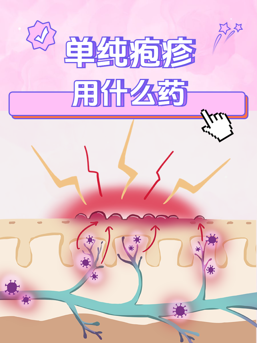 病毒性疱疹怎么治疗