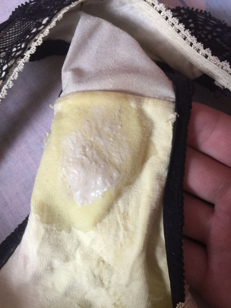 白带发绿的图片