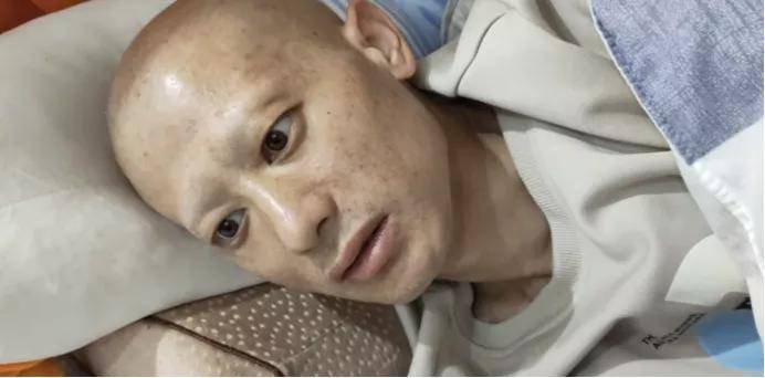 胰腺癌晚期的临死症状是什么