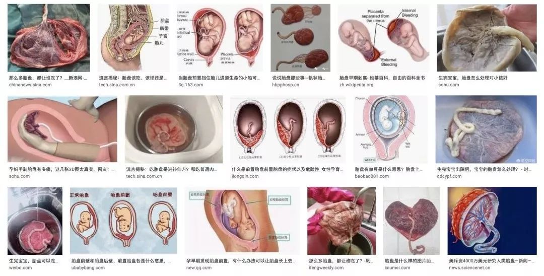 胎盘做成胶囊一天吃几次一次吃几粒