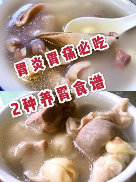 慢性胃炎吃什么