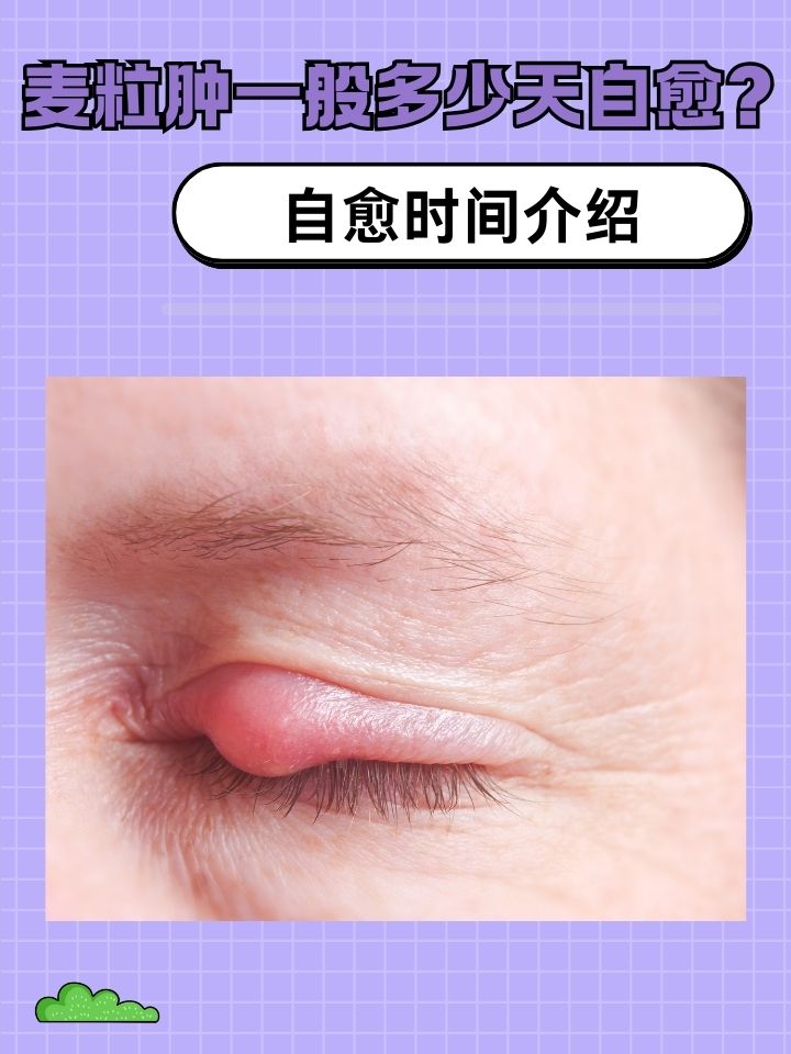 麦粒肿是什么原因