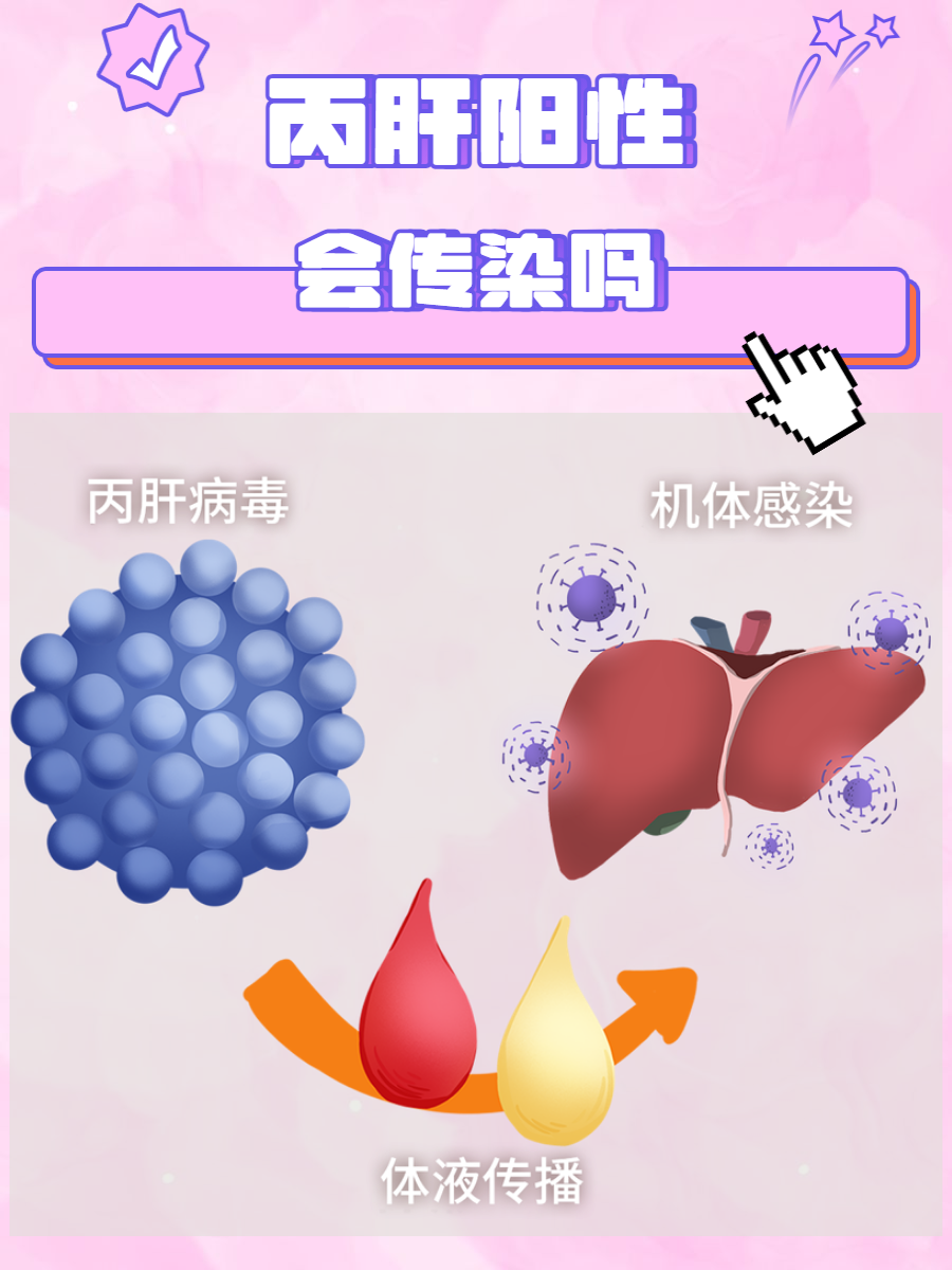 丙肝好治吗