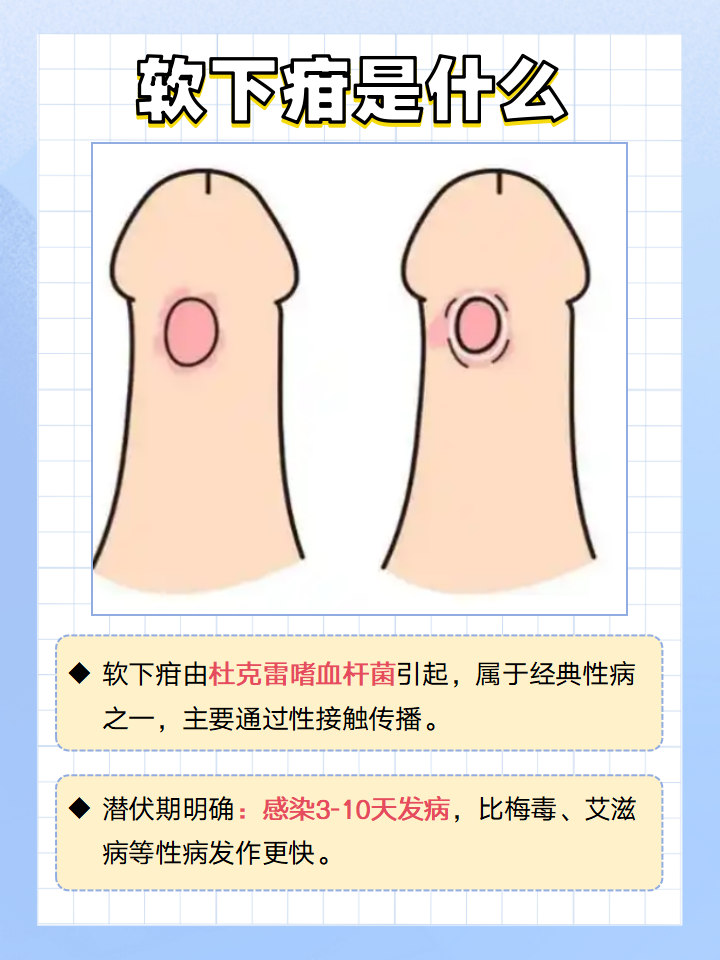 性病潜伏期有多长