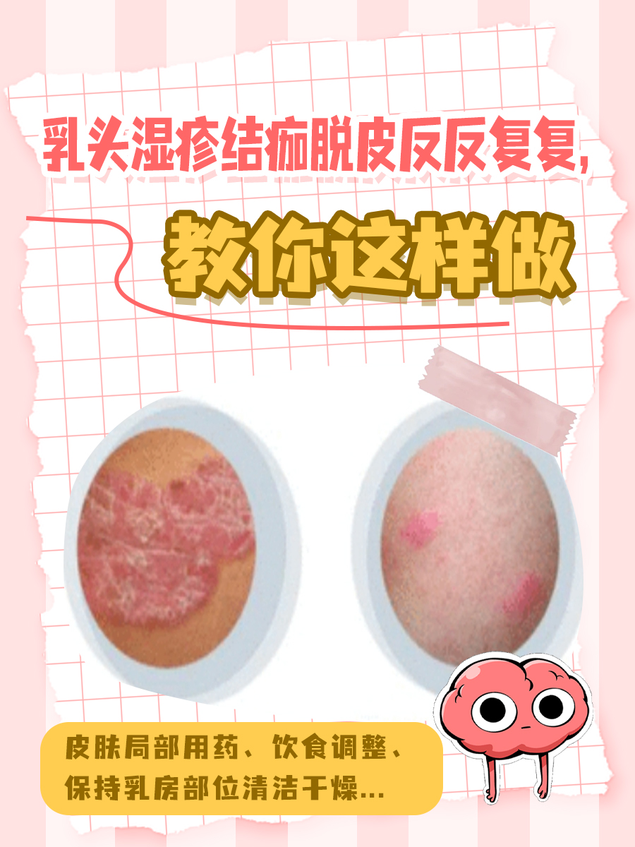 乳头会痒是怎么回事