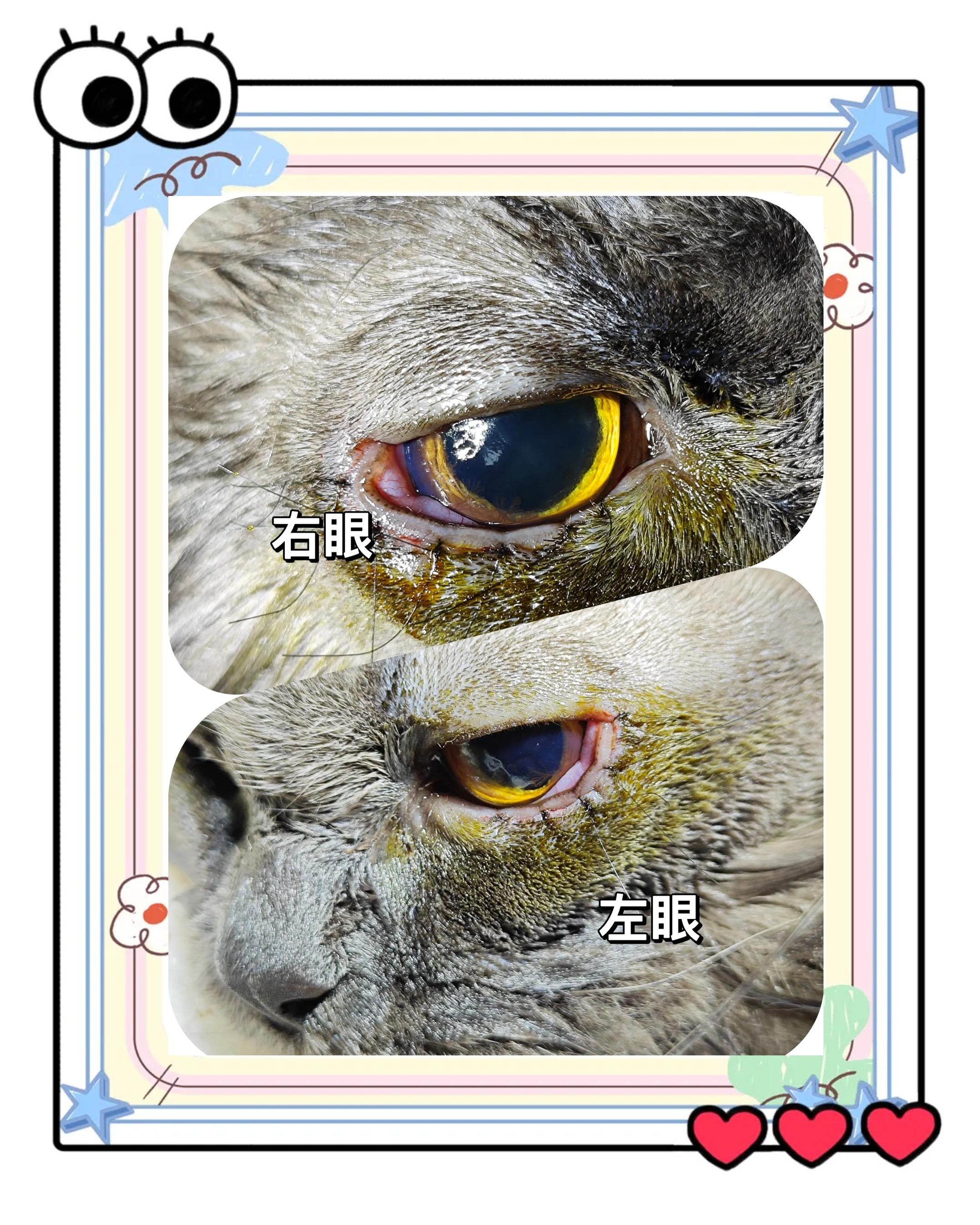 睑内翻是什么？