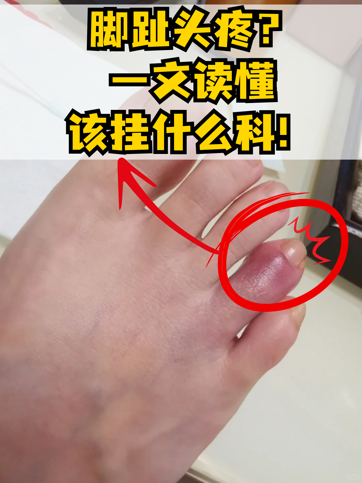 左脚大脚趾头麻木怎么回事?