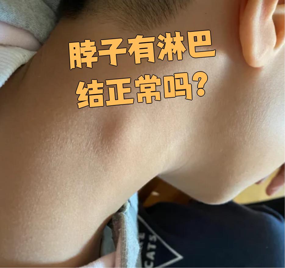 脖子有个肿块会是淋巴癌吗?