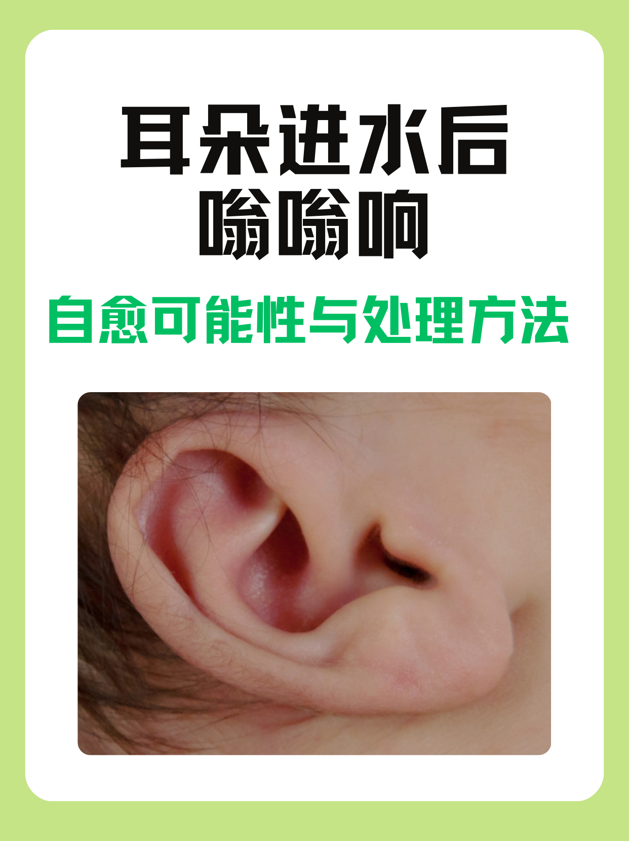 耳朵里进了虫子怎么办