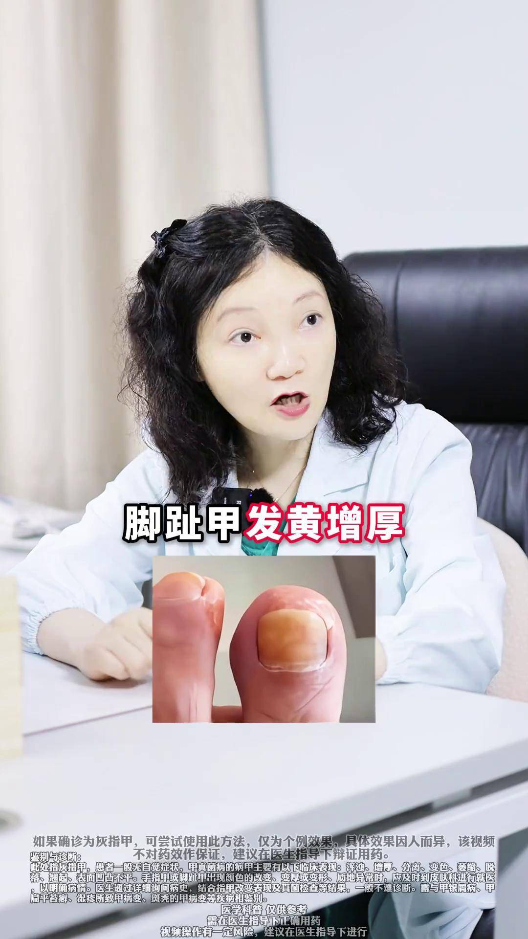 脚指甲发黄是怎么回事