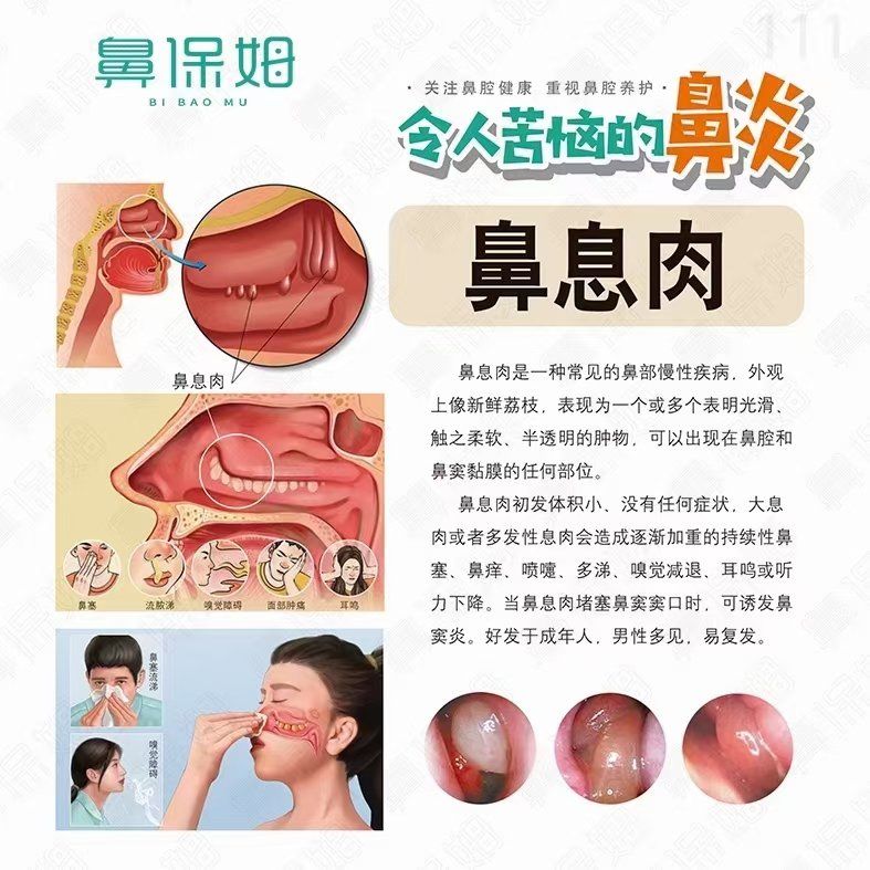 鼻息肉严重吗