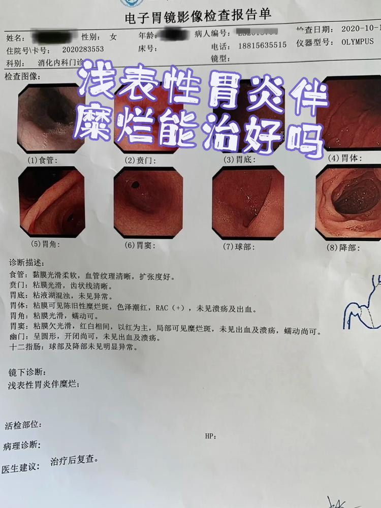 结核性胃炎会传染吗