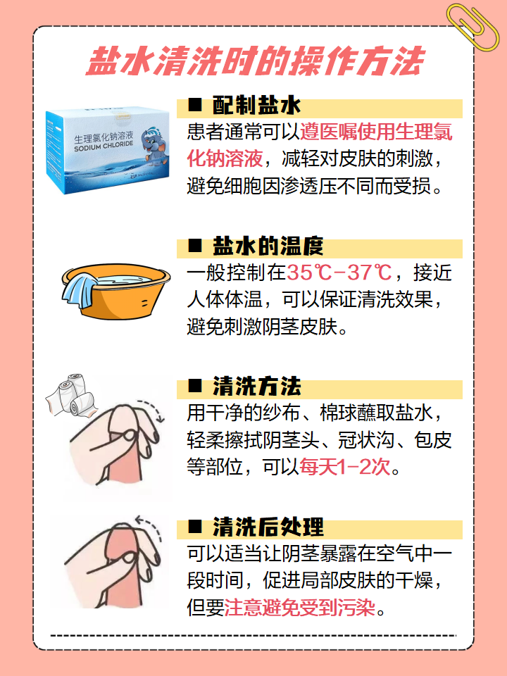 包皮痒怎么办