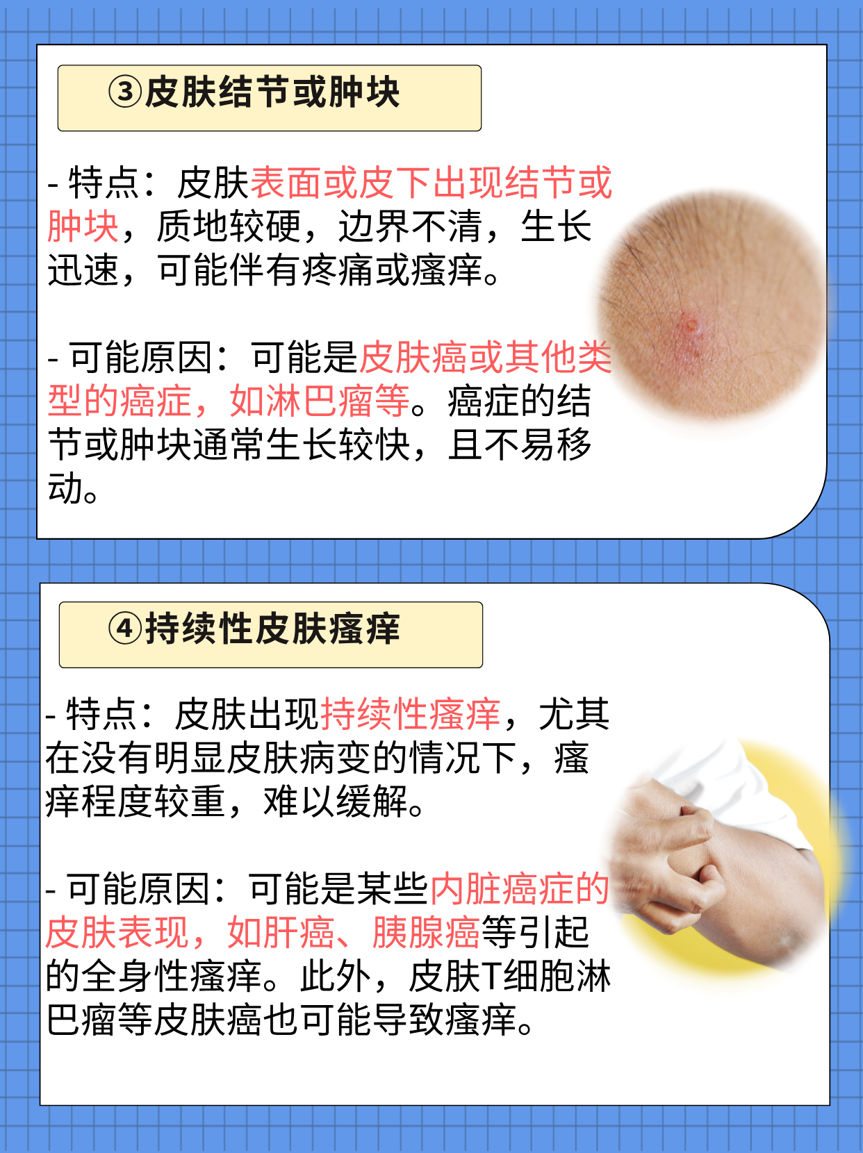 皮肤问题怎么办？常见原因及解决方法