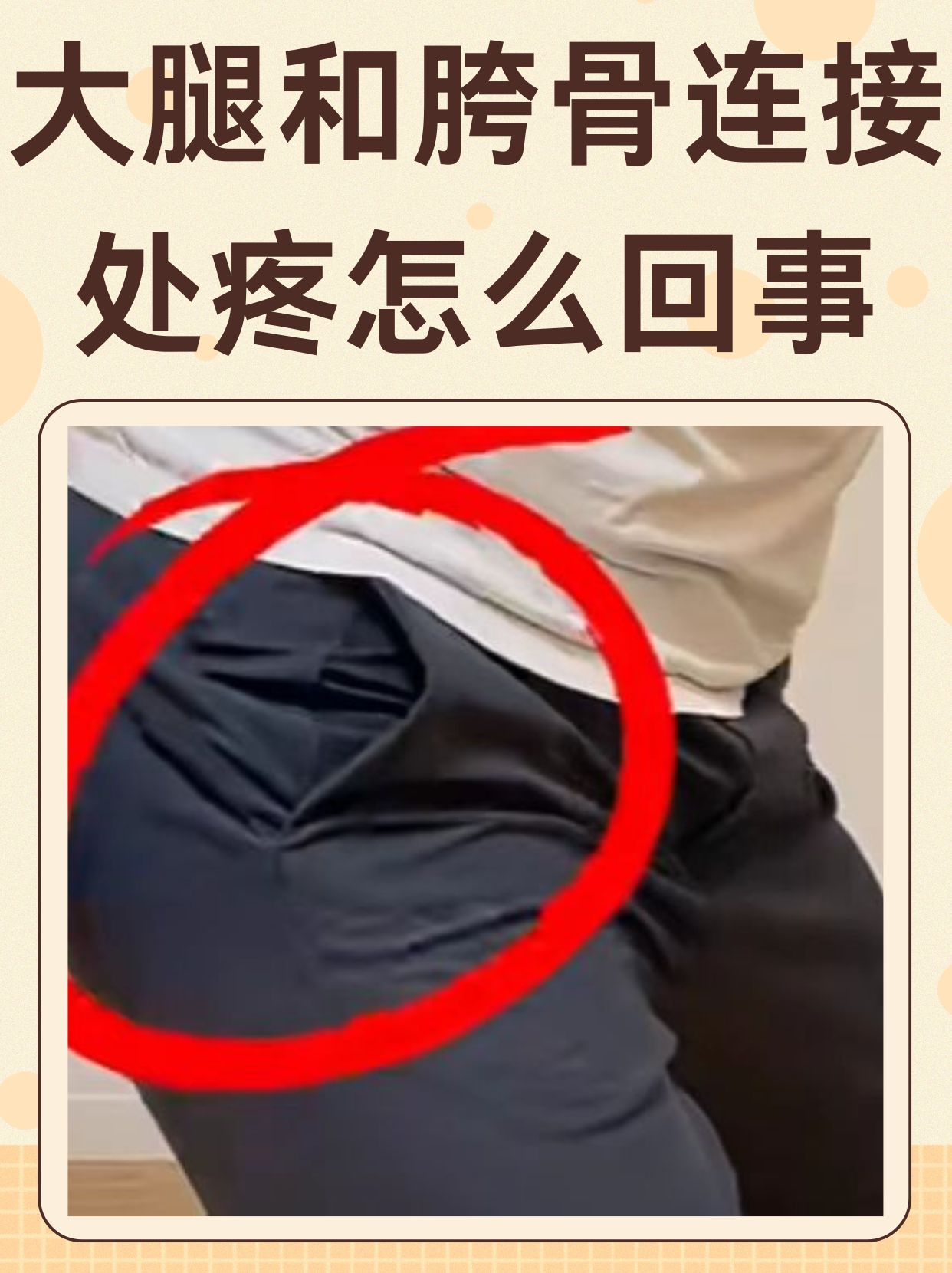 大腿后面的筋疼是怎么回事?