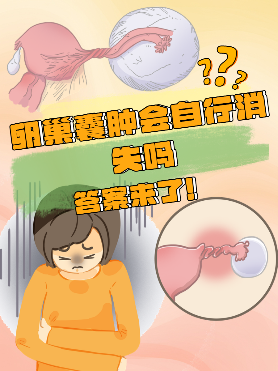 附件囊肿会自己消失吗?