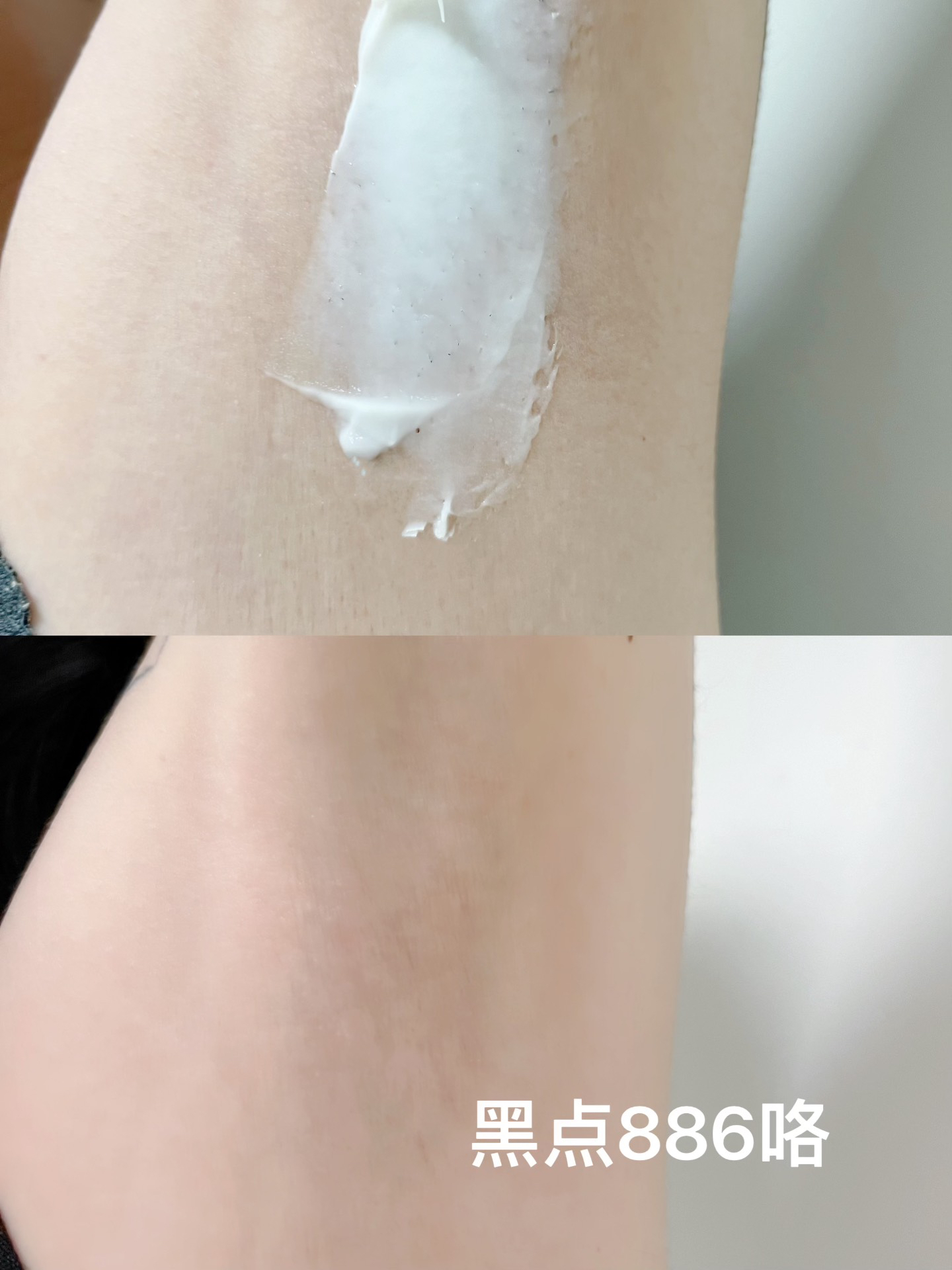 为什么腋毛上有白色的东西?