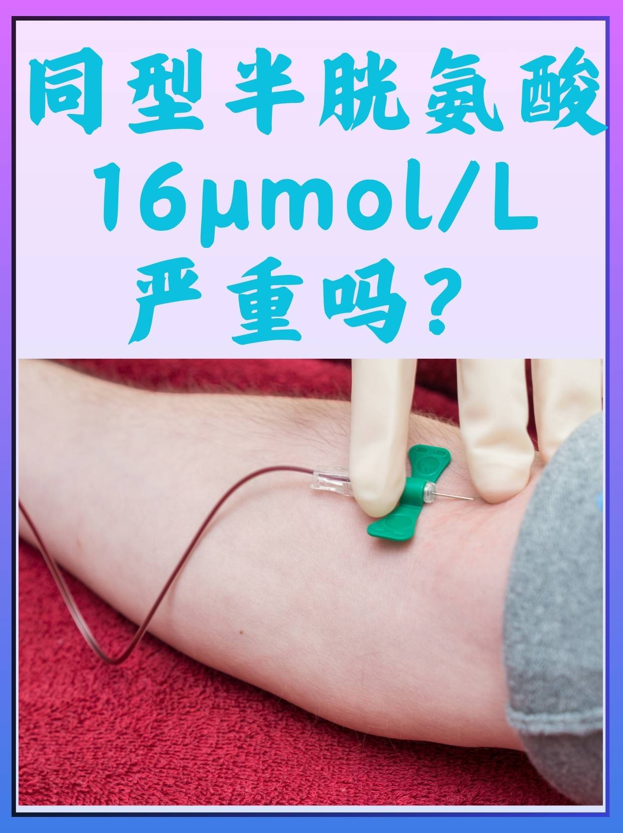 同型半胱氨酸偏高怎么办?
