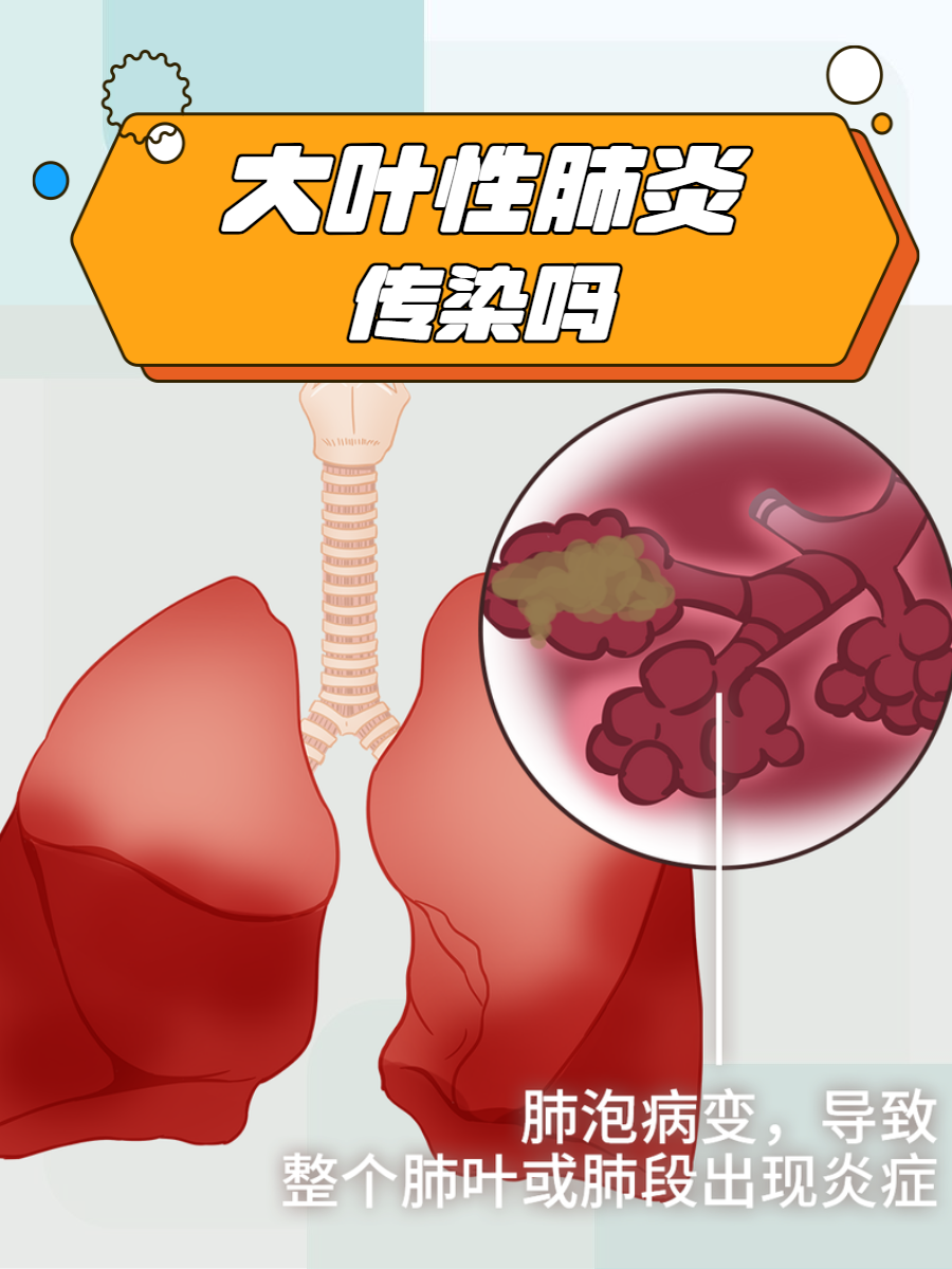 大人肺炎会传染孩子吗