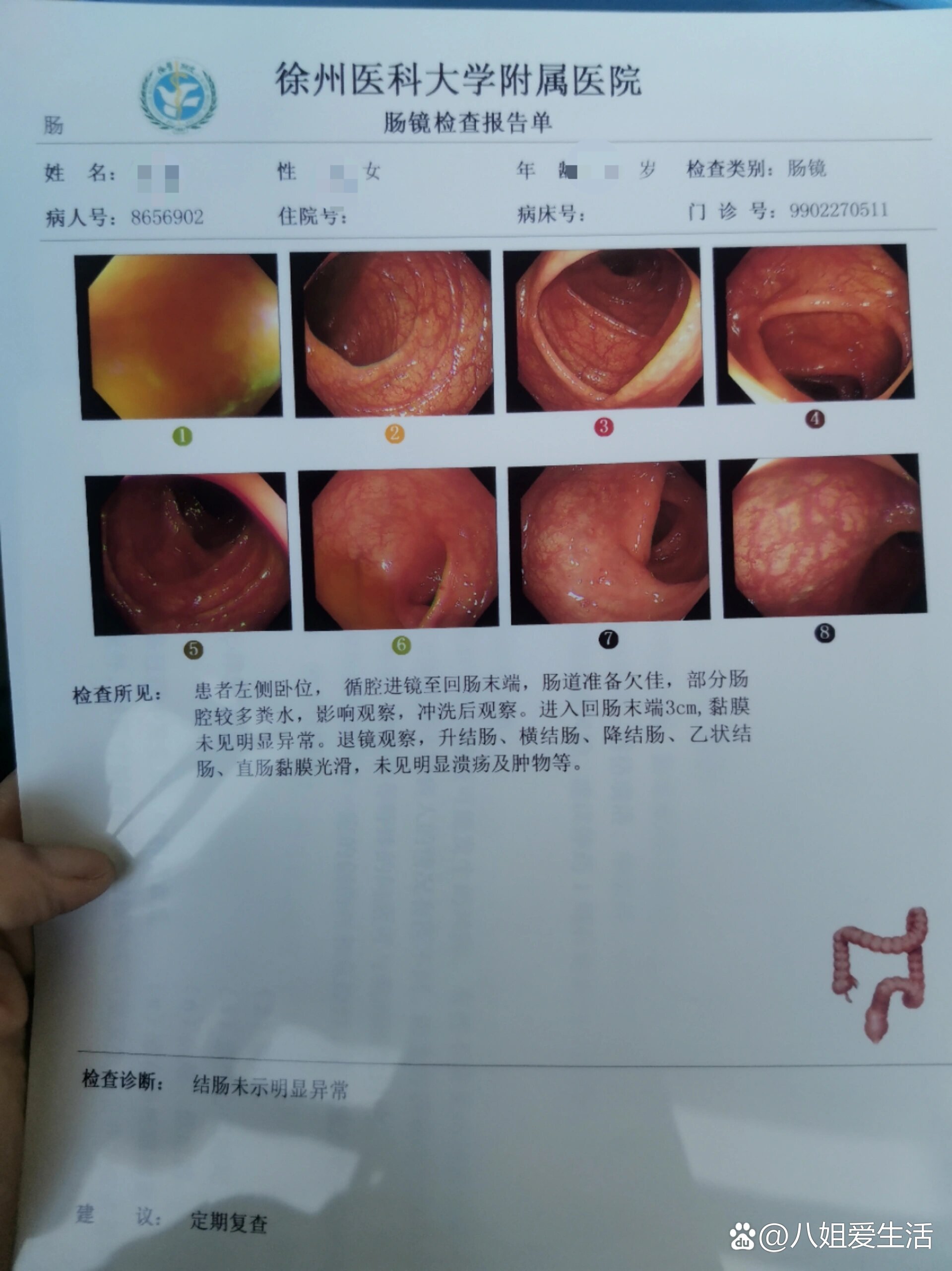 请问一般无痛肠镜大概多少钱
