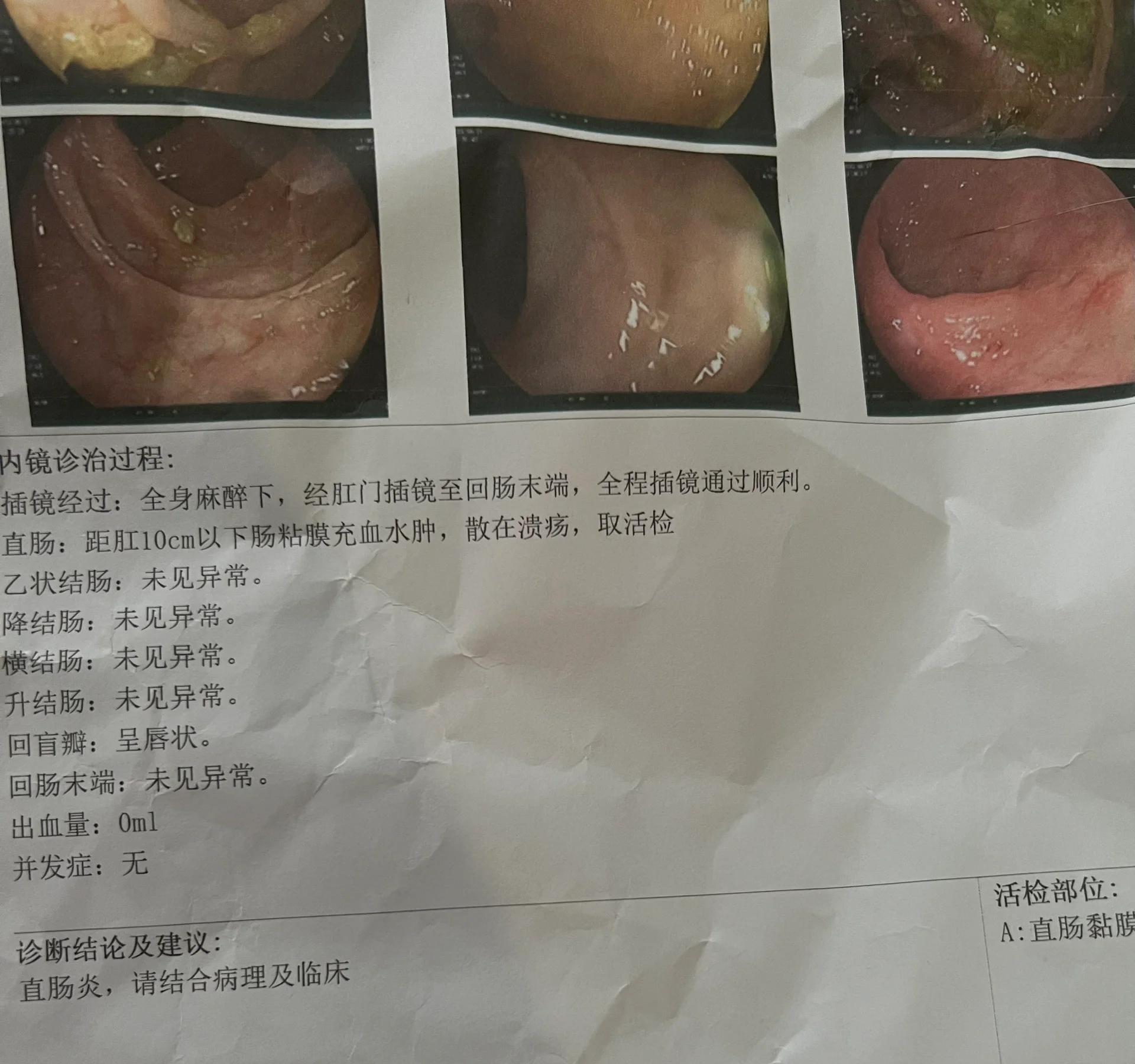 请问一般无痛肠镜大概多少钱