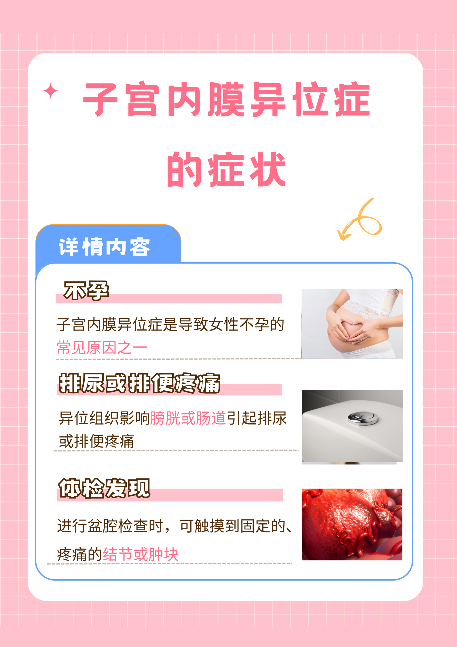 子宫内膜异位症怎么确诊