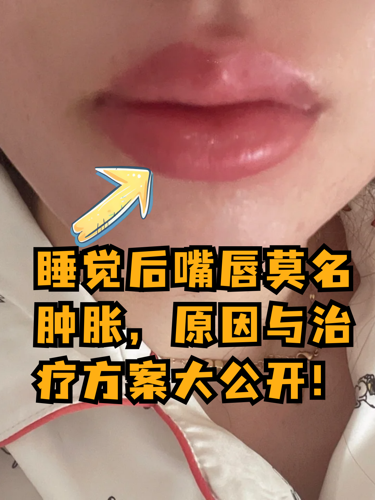 嘴唇麻木是什么原因