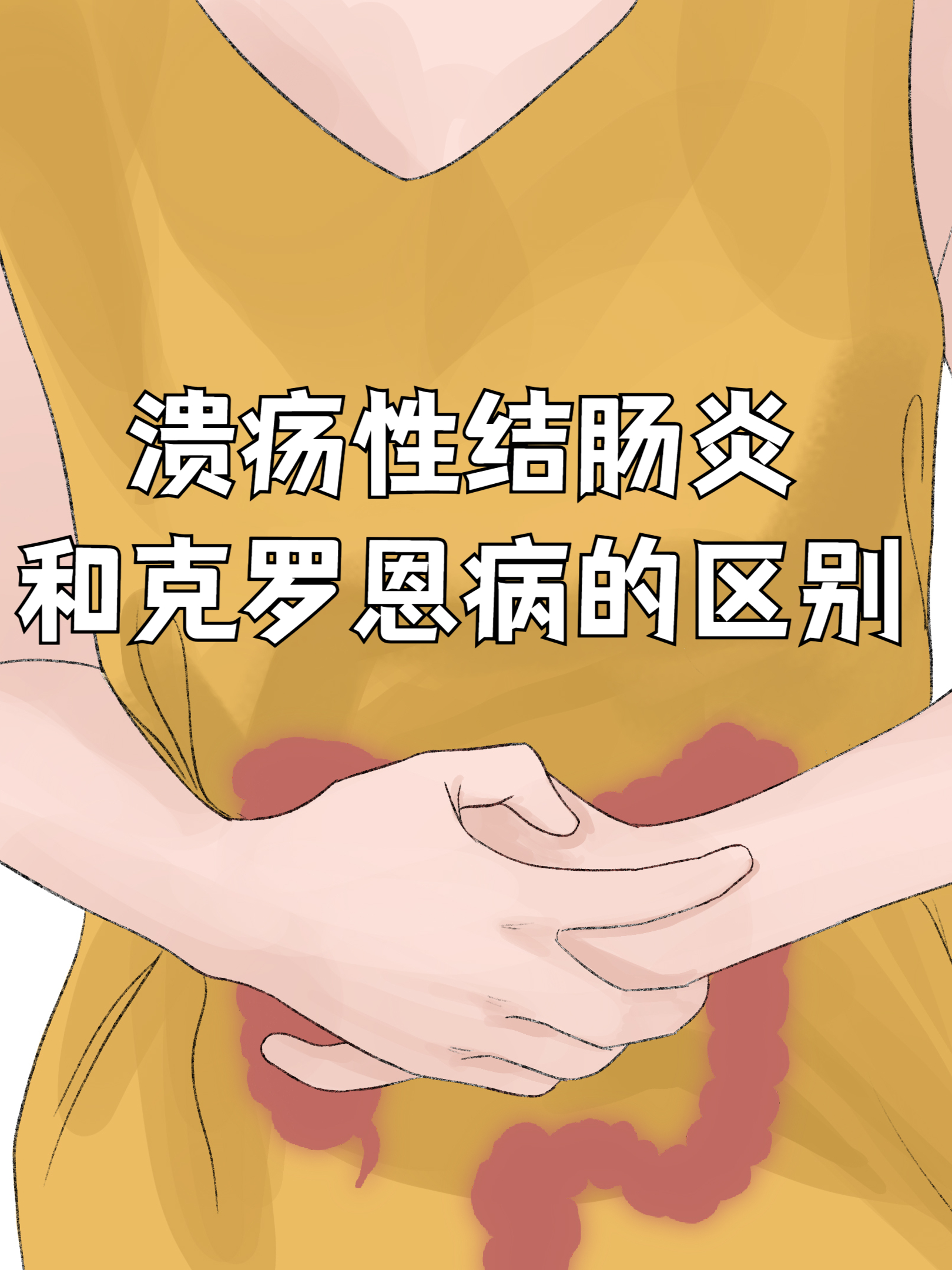 溃疡性结肠炎和克罗恩病的区别