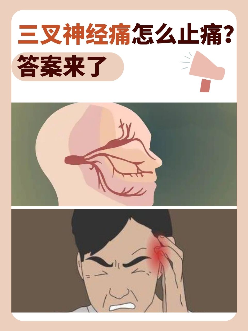 神经痛有哪些症状?