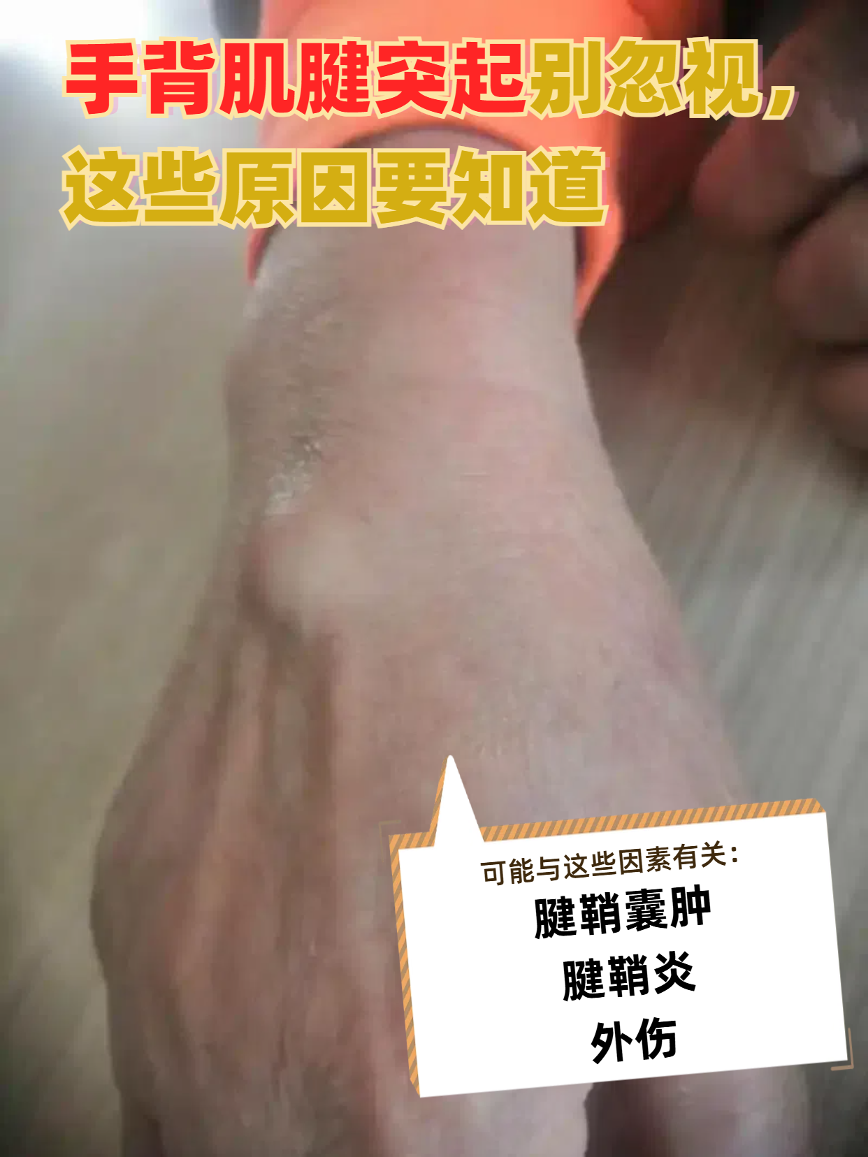 手背痛是什么原因?