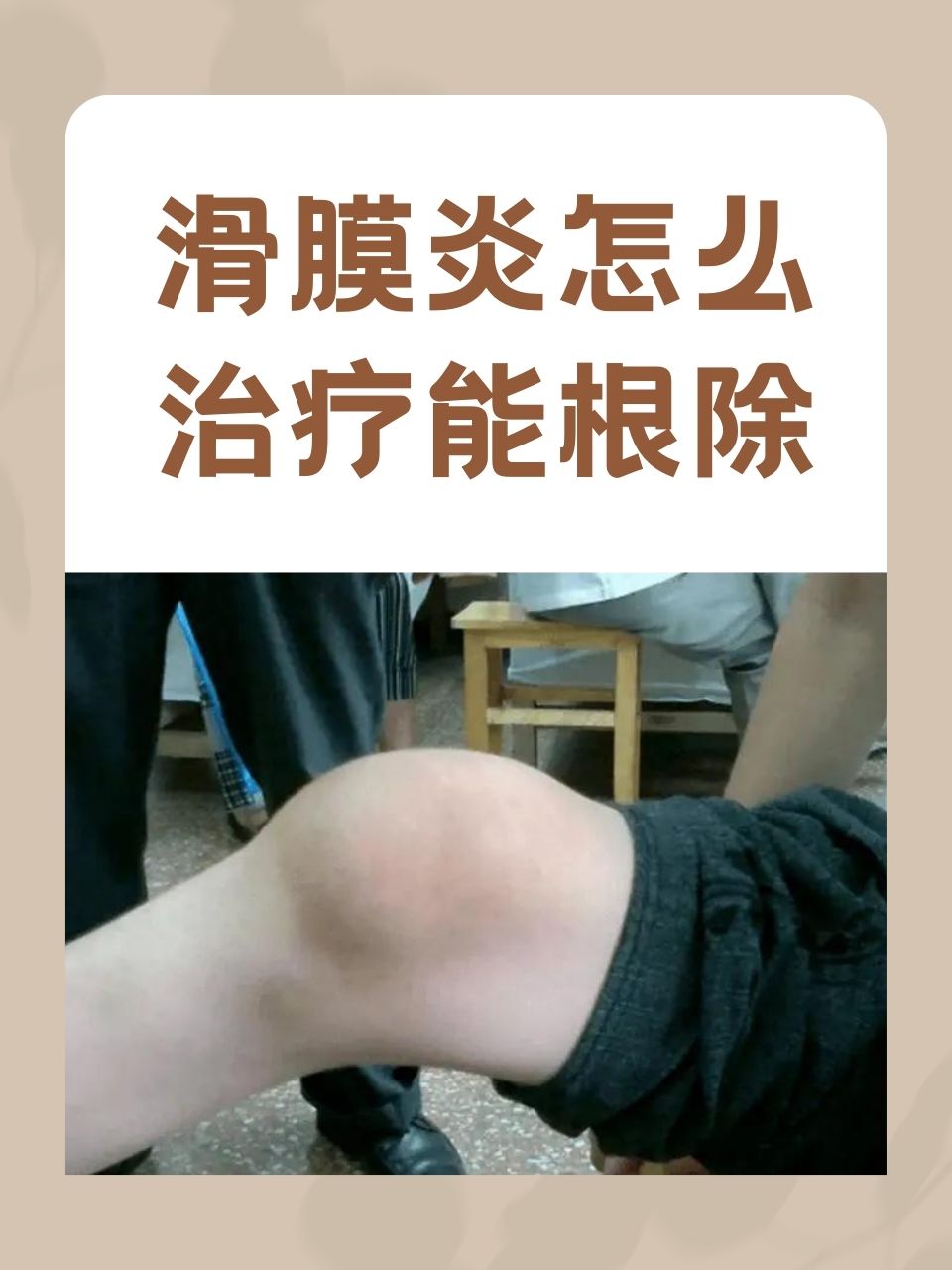 滑膜炎的症状怎么治疗