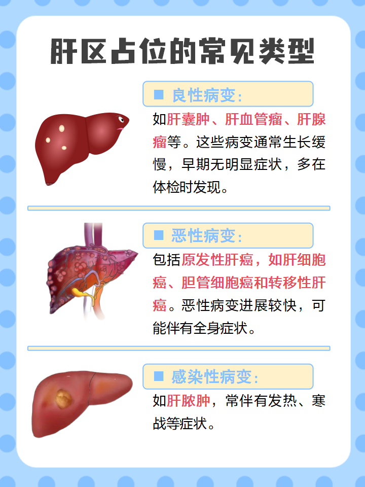 肝内低密度灶是肝癌吗