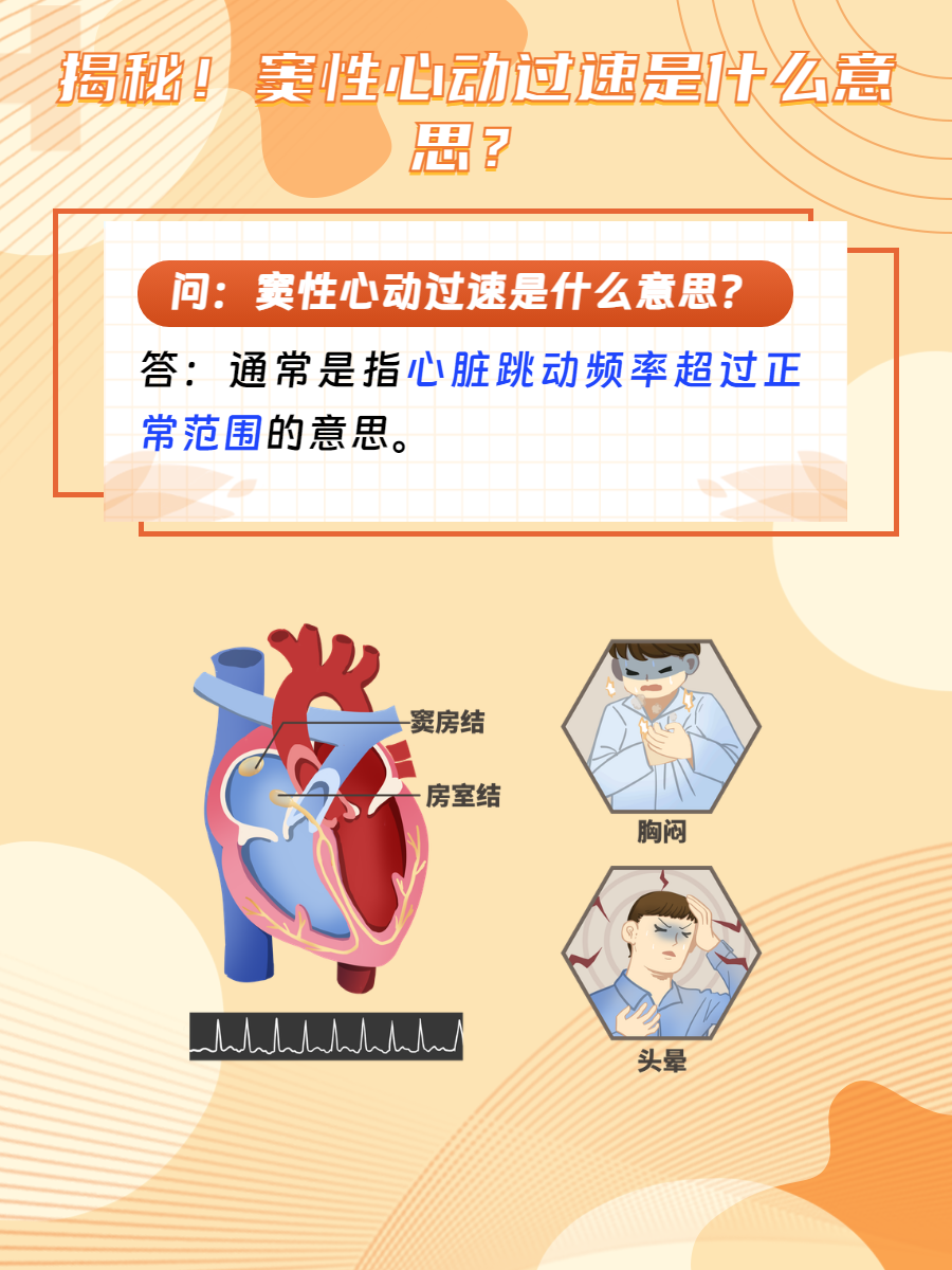 窦性心律过速怎么办