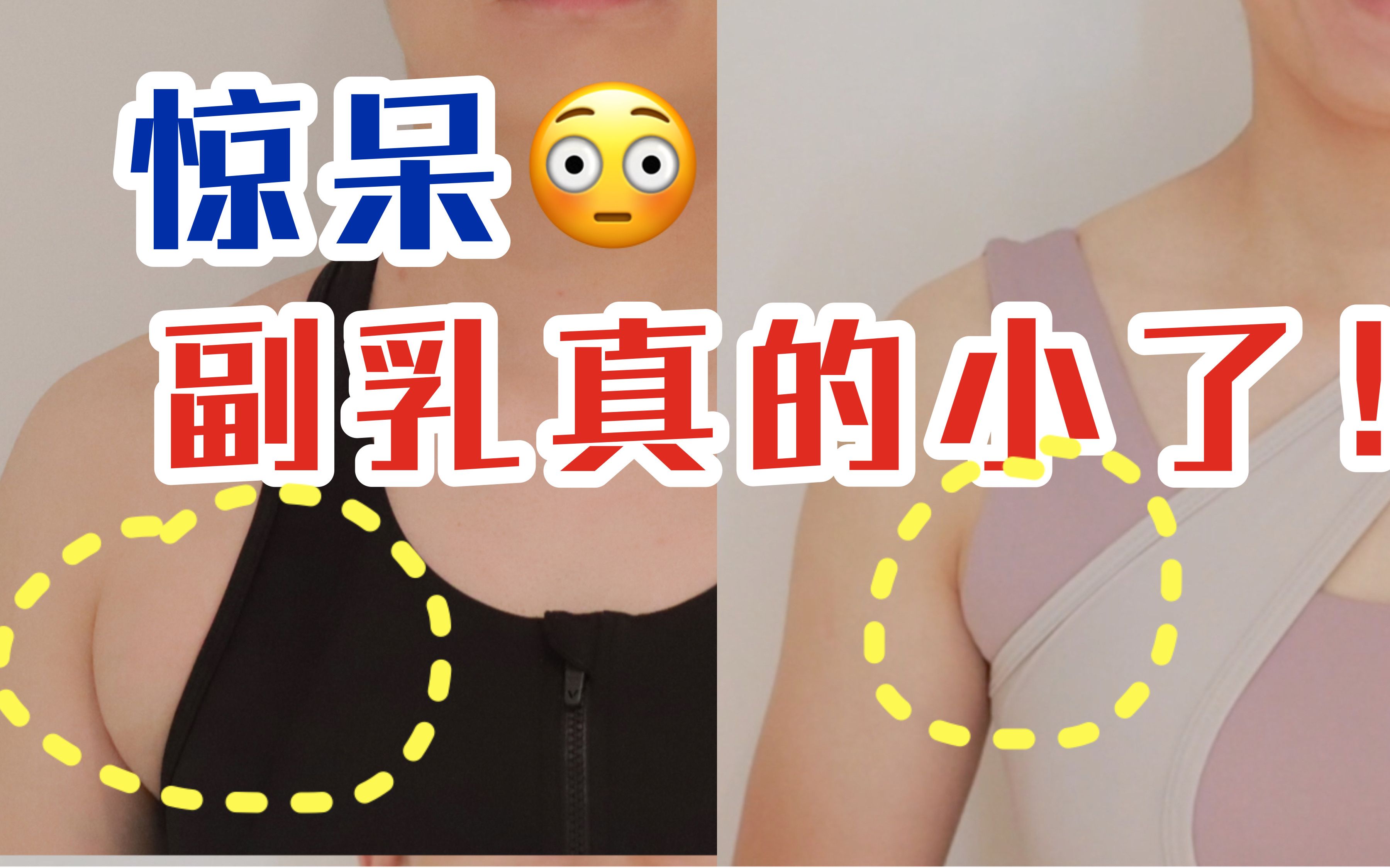 附乳是什么