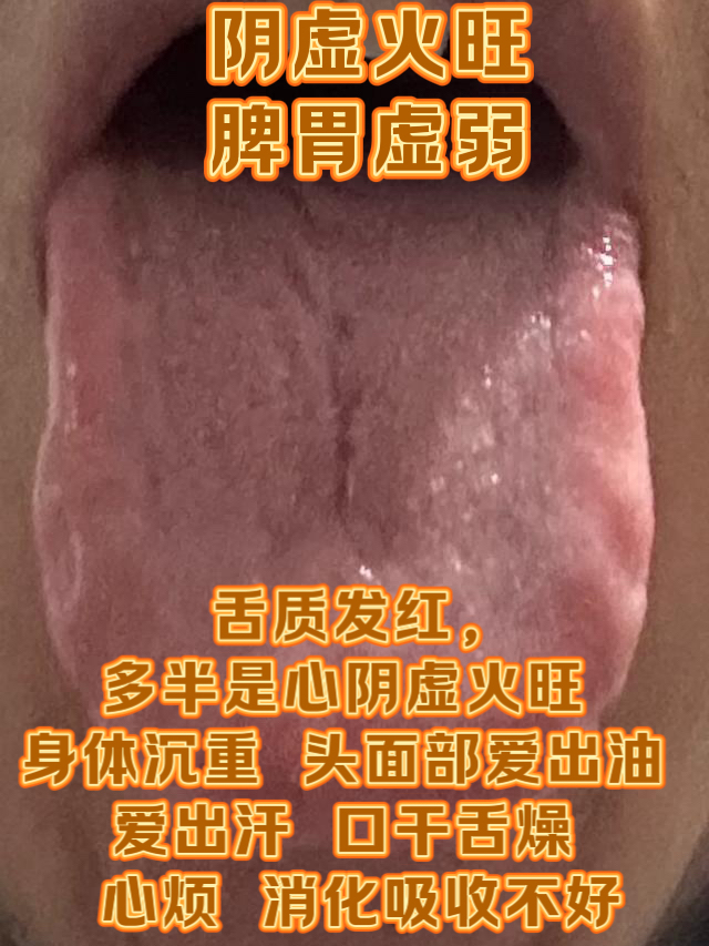 阴虚血热是什么症状?