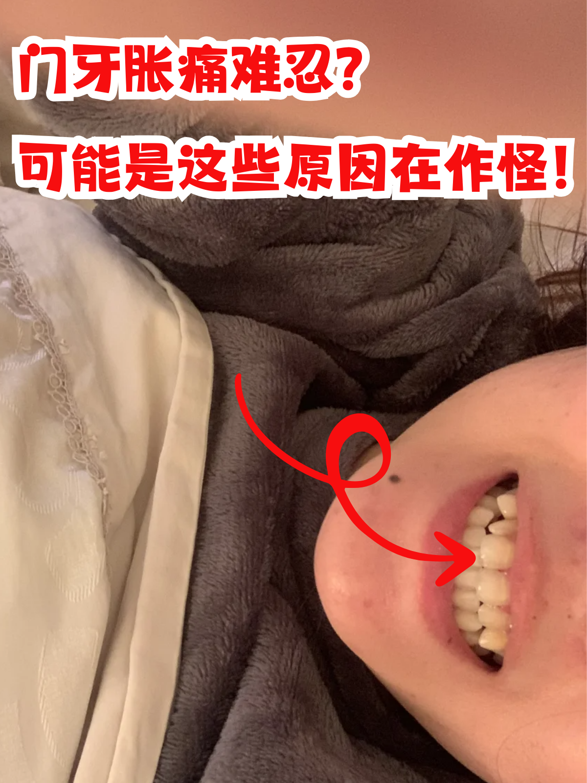 门牙太大怎么办?