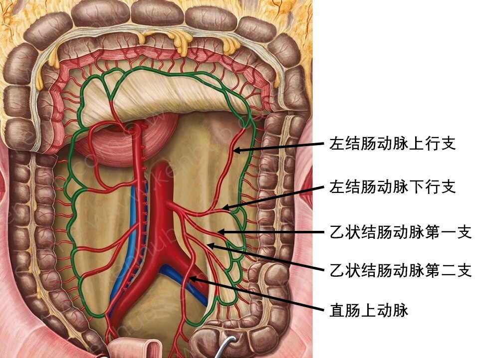 结肠癌怎么做手术?