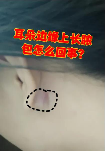 耳朵后面有个大脓包