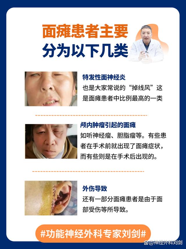 面瘫是可以自愈吗