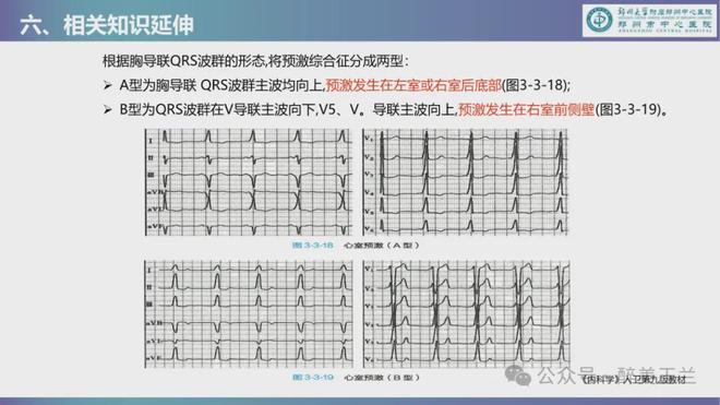 B型预激综合征怎么办