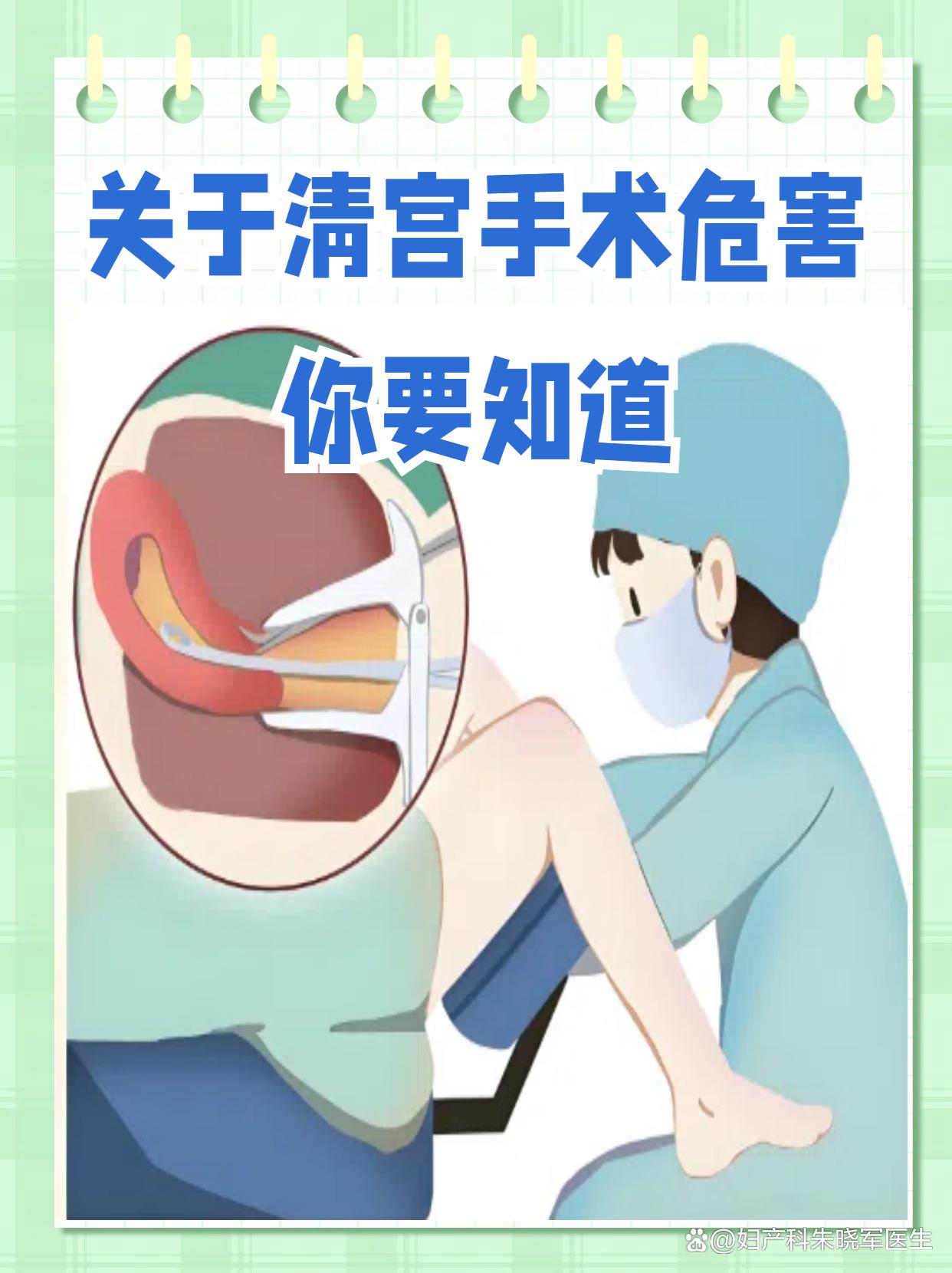 做引产手术
