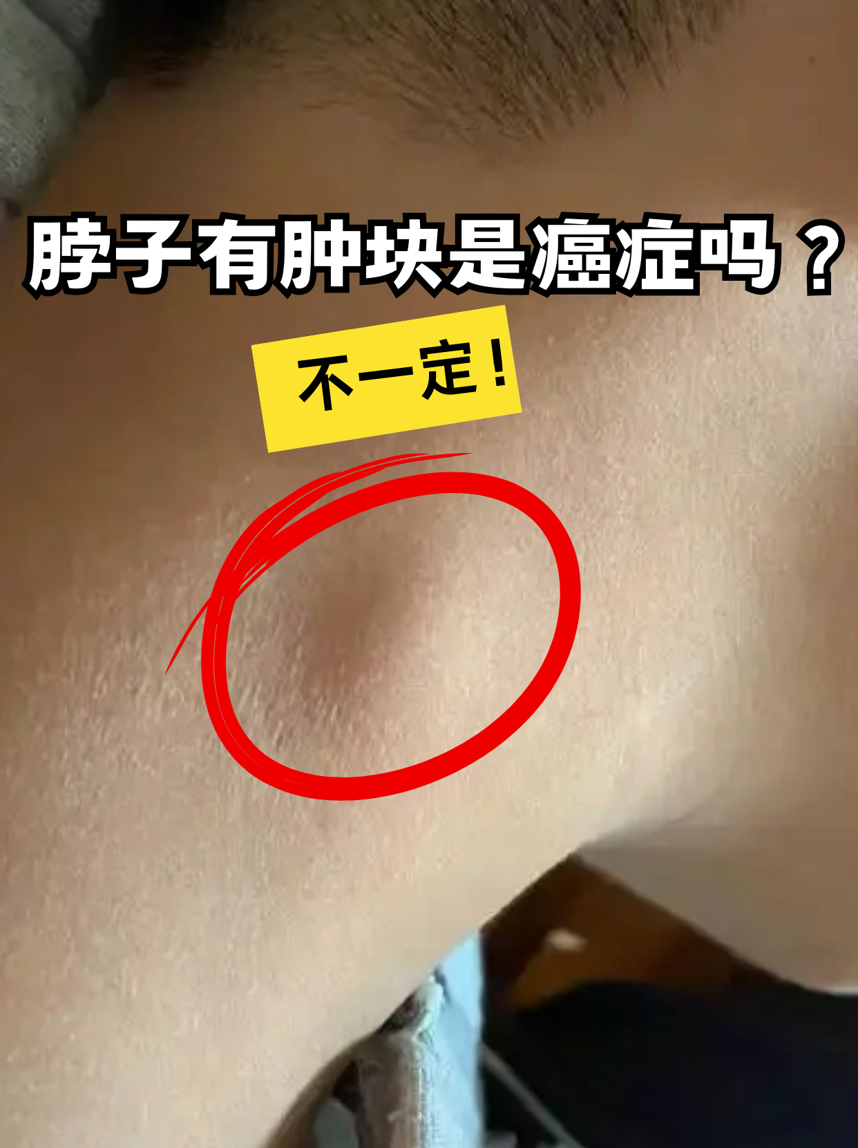 脖子摸到淋巴结正常吗?