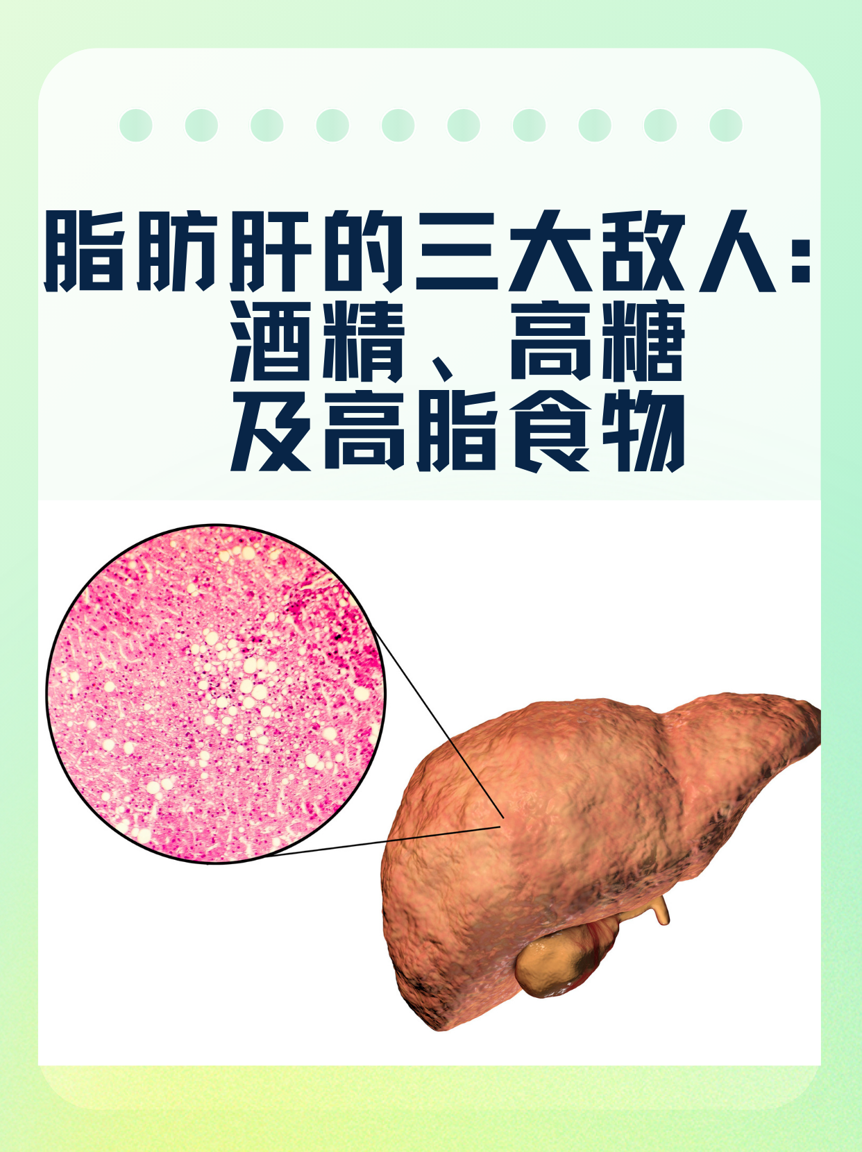 酒精性肝病是什么?