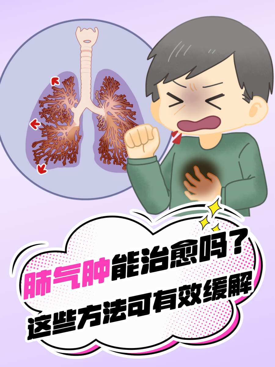 肺气肿的最佳治疗