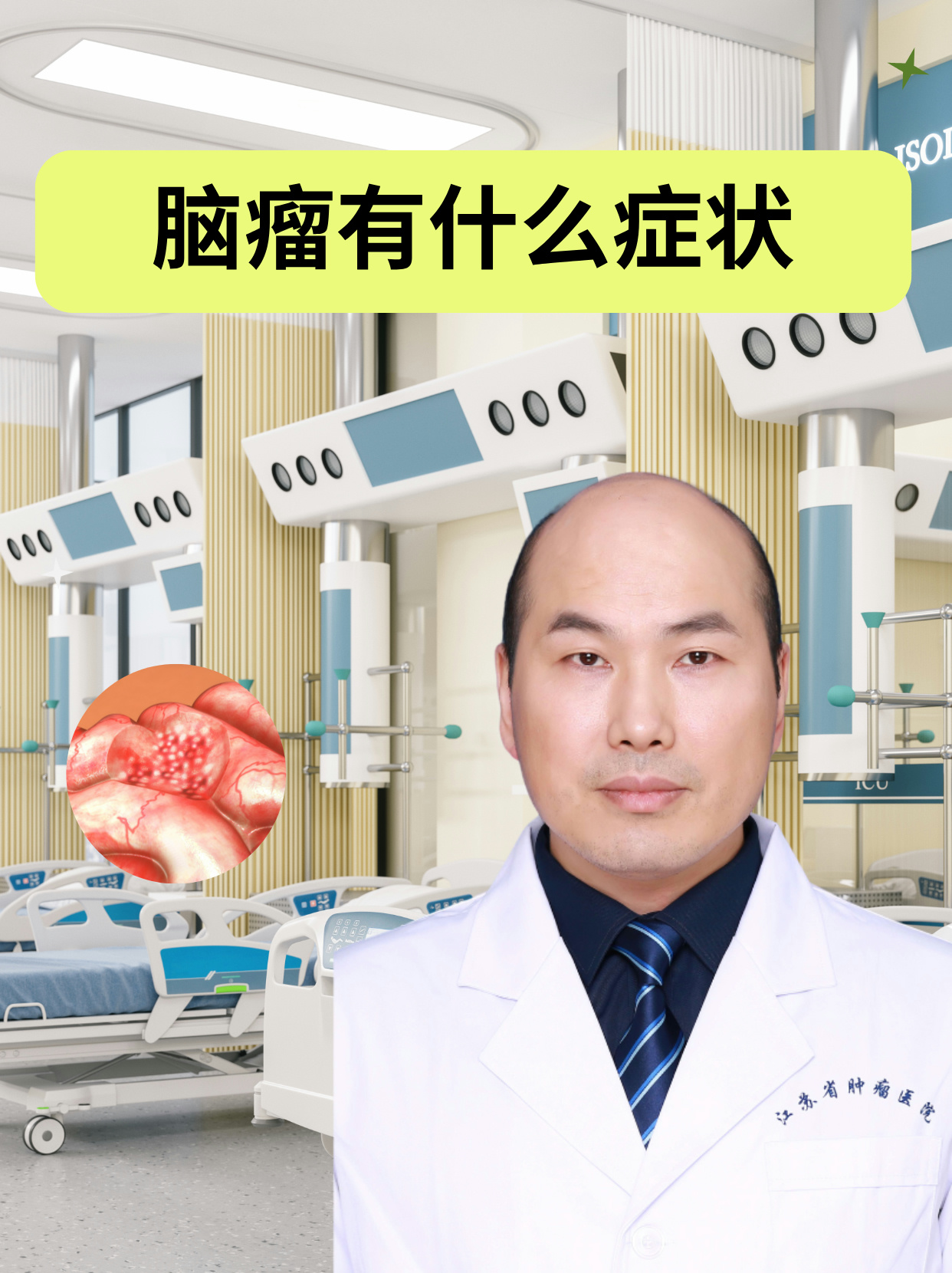 脑肿瘤的早期症状有哪些?