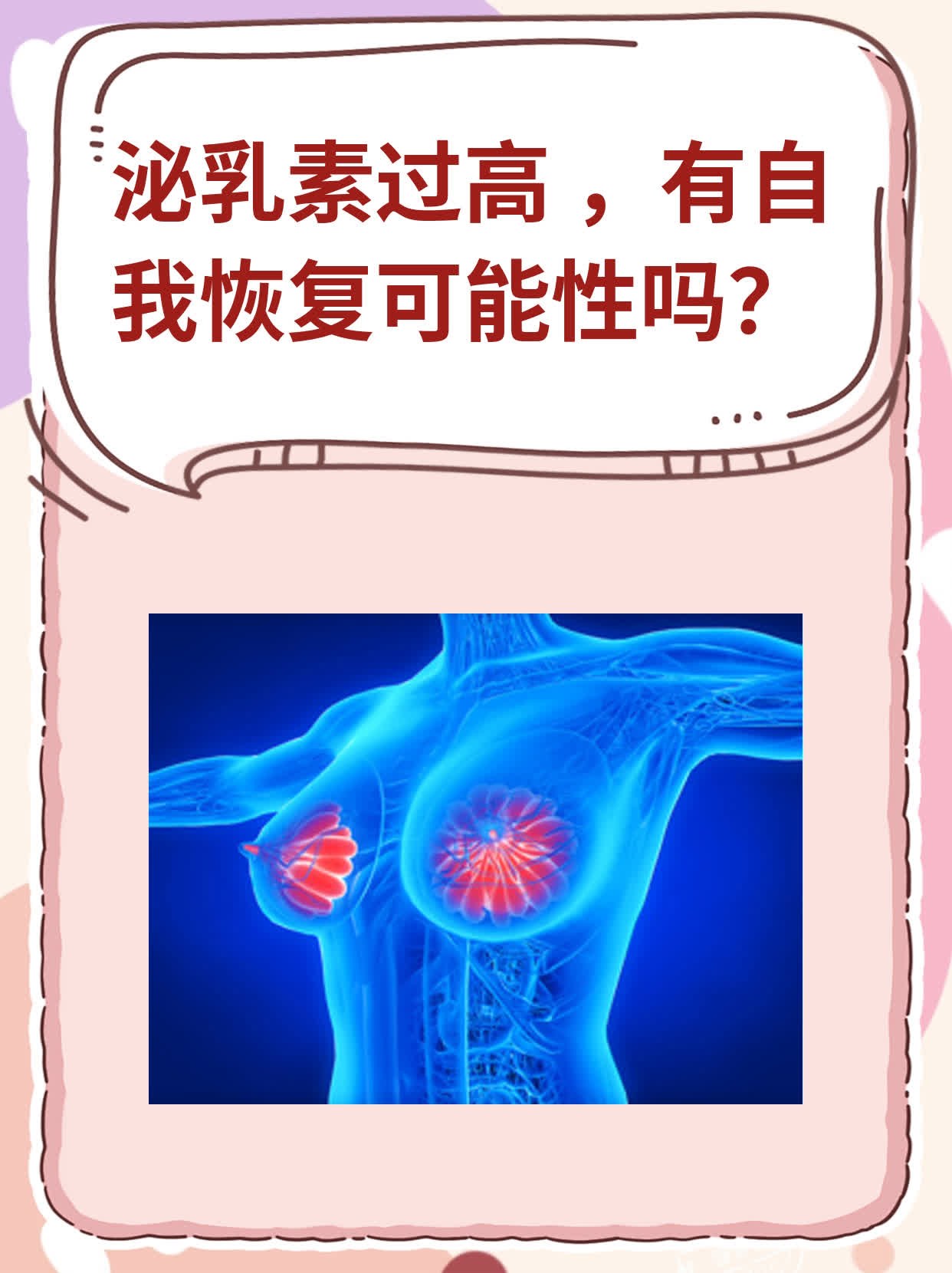 垂体泌乳素高什么原因