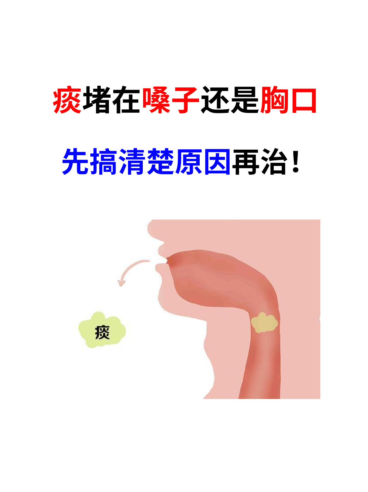 咽喉痰多是什么原因呢